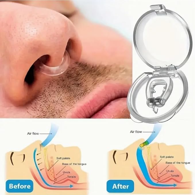 ANTIRONQUIDOS NASAL (4 PIEZAS)